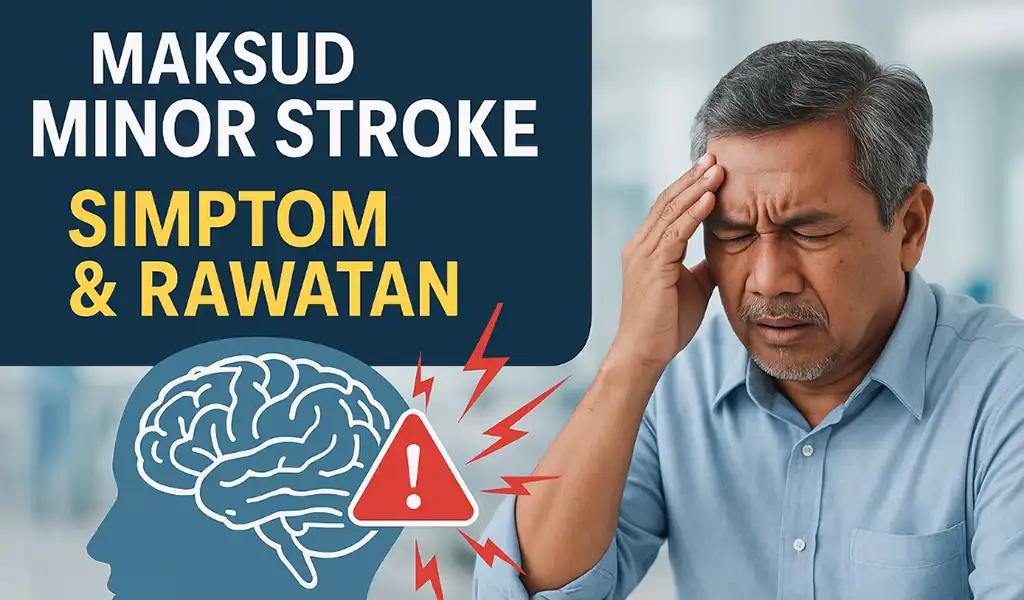Maksud Minor Stroke (TIA)